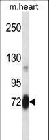 SNK / PLK2 Antibody - Mouse Plk2 Antibody western blot of mouse heart tissue lysates (35 ug/lane). The Plk2 antibody detected the Plk2 protein (arrow).