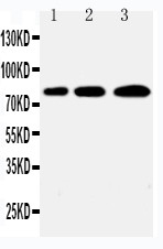 SNK / PLK2 Antibody - WB of SNK / PLK2 antibody. Lane 1: A431 Cell Lysate. Lane 2: 293T Cell Lysate. Lane 3: COLO320 Cell Lysate.
