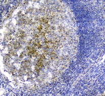 SNK / PLK2 Antibody - IHC analysis of PLK2 using anti-PLK2 antibody. PLK2 was detected in paraffin-embedded section of human tonsil tissues. Heat mediated antigen retrieval was performed in citrate buffer (pH6, epitope retrieval solution) for 20 mins. The tissue section was blocked with 10% goat serum. The tissue section was then incubated with 1µg/ml rabbit anti-PLK2 Antibody overnight at 4°C. Biotinylated goat anti-rabbit IgG was used as secondary antibody and incubated for 30 minutes at 37°C. The tissue section was developed using Strepavidin-Biotin-Complex (SABC) with DAB as the chromogen.