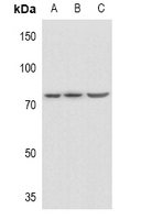 SNK / PLK2 Antibody - Western blot analysis of PLK2 expression in A549 (A), HEK293T (B), LO2 (C) whole cell lysates.