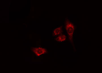 SNK / PLK2 Antibody - Staining HeLa cells by IF/ICC. The samples were fixed with PFA and permeabilized in 0.1% Triton X-100, then blocked in 10% serum for 45 min at 25°C. The primary antibody was diluted at 1:200 and incubated with the sample for 1 hour at 37°C. An Alexa Fluor 594 conjugated goat anti-rabbit IgG (H+L) antibody, diluted at 1/600, was used as secondary antibody.