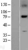 SNK / PLK2 Protein - Western validation with an anti-DDK antibody * L: Control HEK293 lysate R: Over-expression lysate