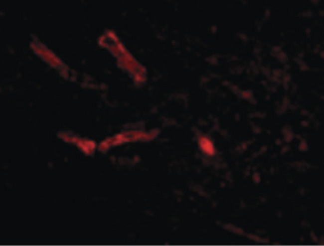 SNPH Antibody - Immunofluorescence of Syntaphilin in Human Brain cells with Syntaphilin antibody at 20 ug/ml.