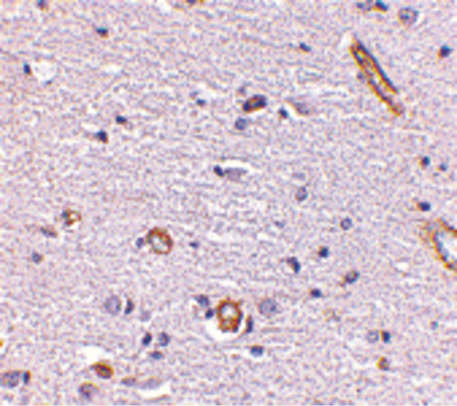 SNPH Antibody - Immunohistochemistry of Syntaphilin in human brain with Syntaphilin antibody at 5 ug/ml.