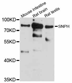 SNPH Antibody - Western blot analysis of extracts of various cell lines, using SNPH antibody at 1:1000 dilution. The secondary antibody used was an HRP Goat Anti-Rabbit IgG (H+L) at 1:10000 dilution. Lysates were loaded 25ug per lane and 3% nonfat dry milk in TBST was used for blocking. An ECL Kit was used for detection and the exposure time was 30s.