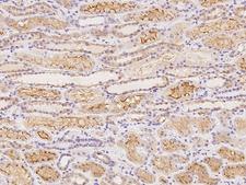 SNPH Antibody - Immunochemical staining of human SNPH in human kidney with rabbit polyclonal antibody at 1:100 dilution, formalin-fixed paraffin embedded sections.