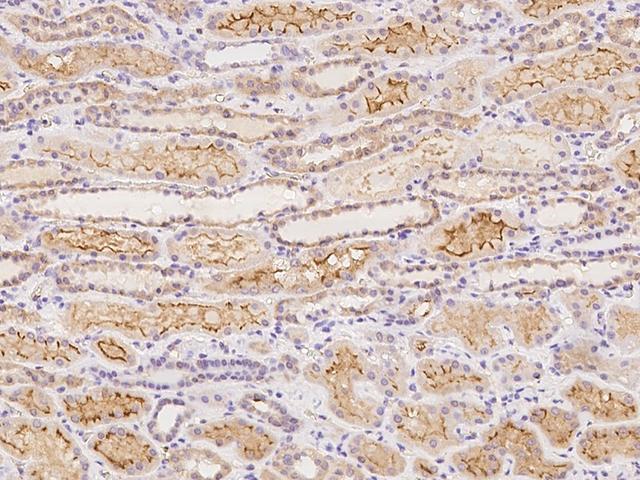 SNPH Antibody - Immunochemical staining of human SNPH in human kidney with rabbit polyclonal antibody at 1:100 dilution, formalin-fixed paraffin embedded sections.