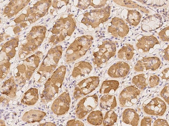 SNPH Antibody - Immunochemical staining of human SNPH in human stomach with rabbit polyclonal antibody at 1:100 dilution, formalin-fixed paraffin embedded sections.