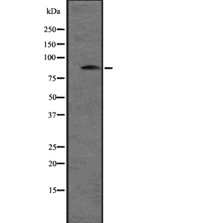 SNRK Antibody - Western blot analysis of SNRK expression in A431 whole cells lysate. The lane on the left is treated with the antigen-specific peptide.