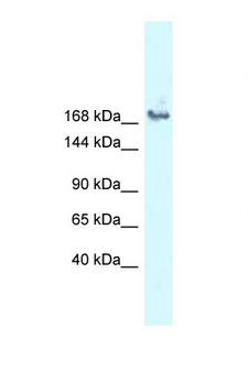 SNRNP200 Antibody - SNRNP200 antibody Western blot of COL0205 Cell lysate. Antibody concentration 1 ug/ml.  This image was taken for the unconjugated form of this product. Other forms have not been tested.