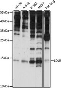 SNRNP25 Antibody - Western blot analysis of extracts of various cell lines, using SNRNP25 antibody at 1:1000 dilution. The secondary antibody used was an HRP Goat Anti-Rabbit IgG (H+L) at 1:10000 dilution. Lysates were loaded 25ug per lane and 3% nonfat dry milk in TBST was used for blocking. An ECL Kit was used for detection and the exposure time was 30s.