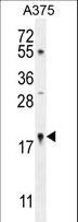 SNRNP27 Antibody - SNR27 Antibody western blot of A375 cell line lysates (35 ug/lane). The SNR27 antibody detected the SNR27 protein (arrow).