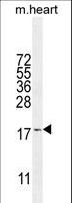SNRNP27 Antibody - SNR27 Antibody western blot of mouse heart tissue lysates (35 ug/lane). The SNR27 antibody detected the SNR27 protein (arrow).