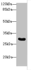 SNRNP35 Antibody - Western blot All lanes: Snrnp35 antibody at 12µg/ml + Jurkat whole cell lysate Secondary Goat polyclonal to rabbit IgG at 1/10000 dilution Predicted band size: 29 kDa Observed band size: 29 kDa