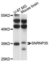 SNRNP35 Antibody - Western blot analysis of extracts of various cell lines, using SNRNP35 antibody at 1:3000 dilution. The secondary antibody used was an HRP Goat Anti-Rabbit IgG (H+L) at 1:10000 dilution. Lysates were loaded 25ug per lane and 3% nonfat dry milk in TBST was used for blocking. An ECL Kit was used for detection and the exposure time was 10s.
