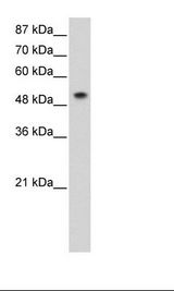 SNRP70 / SNRNP70 Antibody - Jurkat Cell Lysate.  This image was taken for the unconjugated form of this product. Other forms have not been tested.