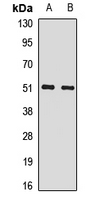 SNRP70 / SNRNP70 Antibody