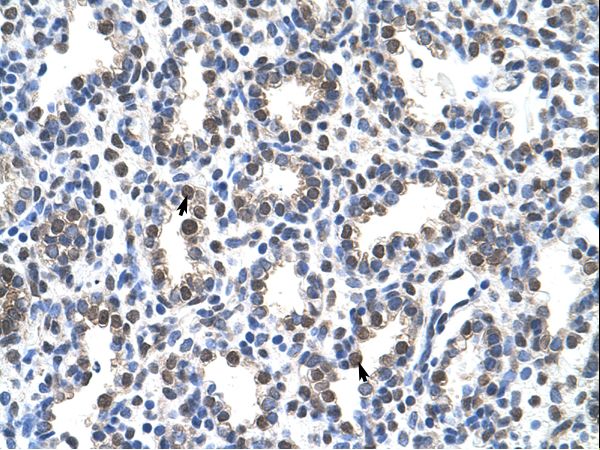 SNRPA / U1A Antibody - Human Lung.  This image was taken for the unconjugated form of this product. Other forms have not been tested.