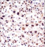 SNRPA / U1A Antibody - SNRPA Antibody immunohistochemistry of formalin-fixed and paraffin-embedded human liver tissue followed by peroxidase-conjugated secondary antibody and DAB staining.