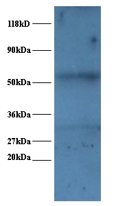 SNRPA / U1A Antibody - Western blot of U1 small nuclear ribonucleoprotein A polyclonal Antibody at 2 ug/ml + EC109 whole cell lysate at 20 ug. Secondary: Goat polyclonal to Rabbit IgG at 1:15000 dilution. Predicted band size: 31 kDa. Observed band size: 31 kDa Additional bands at: 52 kDa. We are unsure as to the identity of this extra band.  This image was taken for the unconjugated form of this product. Other forms have not been tested.