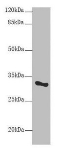 SNRPA / U1A Antibody - Western blot All lanes: SNRPA antibody at 9µg/ml + Mouse liver tissue Secondary Goat polyclonal to rabbit IgG at 1/10000 dilution Predicted band size: 31 kDa Observed band size: 31 kDa