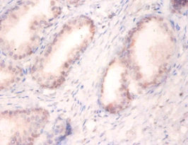 SNRPA / U1A Antibody - Immunohistochemistry of paraffin-embedded human prostate tissue using SNRPA Antibody at dilution of 1:100