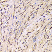 SNRPA / U1A Antibody - Immunohistochemistry of paraffin-embedded Human adenomyosis.