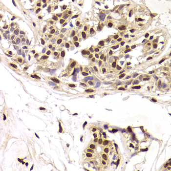 SNRPA / U1A Antibody - Immunohistochemistry of paraffin-embedded Human mammary gland tissue.
