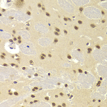 SNRPA / U1A Antibody - Immunohistochemistry of paraffin-embedded Mouse brain tissue.