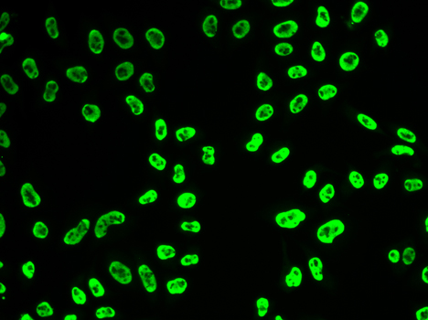 SNRPA / U1A Antibody - Immunofluorescence analysis of HeLa cells.