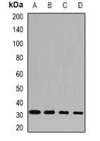 SNRPA / U1A Antibody - Western blot analysis of SNRPA expression in A431 (A); MCF7 (B); mouse testis (C); rat brain (D) whole cell lysates.