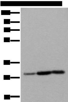 SNRPA / U1A Antibody - Western blot analysis of Human heart tissue A431 cell Human fetal liver tissue lysates  using SNRPA Polyclonal Antibody at dilution of 1:550