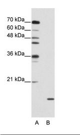SNRPA1 Antibody - A: Marker, B: Jurkat Cell Lysate.  This image was taken for the unconjugated form of this product. Other forms have not been tested.