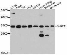 SNRPA1 Antibody - Western blot analysis of extracts of various cell lines, using SNRPA1 antibody at 1:3000 dilution. The secondary antibody used was an HRP Goat Anti-Rabbit IgG (H+L) at 1:10000 dilution. Lysates were loaded 25ug per lane and 3% nonfat dry milk in TBST was used for blocking. An ECL Kit was used for detection and the exposure time was 10s.