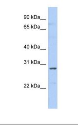 SNRPA1 Antibody - Fetal liver lysate. Antibody concentration: 1.0 ug/ml. Gel concentration: 12%.  This image was taken for the unconjugated form of this product. Other forms have not been tested.