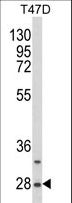 SNRPB / COD Antibody - Western blot of SNRPB Antibody (N-term R49) in T47D cell line lysates (35 ug/lane). SNRPB (arrow) was detected using the purified antibody.