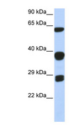 SNRPB / COD Antibody - SNRPB antibody Western blot of 293T cell lysate. This image was taken for the unconjugated form of this product. Other forms have not been tested.