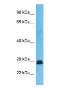 SNRPB / COD Antibody - Western blot of RSMB Antibody with human Fetal Lung lysate.  This image was taken for the unconjugated form of this product. Other forms have not been tested.