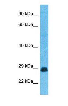 SNRPB / COD Antibody - Western blot of RSMB Antibody with human Fetal Lung lysate.  This image was taken for the unconjugated form of this product. Other forms have not been tested.