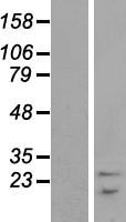 SNRPB / COD Protein - Western validation with an anti-DDK antibody * L: Control HEK293 lysate R: Over-expression lysate