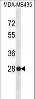 SNRPB2 Antibody - SNRPB2 Antibody western blot of MDA-MB435 cell line lysates (35 ug/lane). The SNRPB2 antibody detected the SNRPB2 protein (arrow).