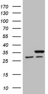 SNRPB2 Antibody - HEK293T cells were transfected with the pCMV6-ENTRY control (Left lane) or pCMV6-ENTRY SNRPB2 (Right lane) cDNA for 48 hrs and lysed. Equivalent amounts of cell lysates (5 ug per lane) were separated by SDS-PAGE and immunoblotted with anti-SNRPB2 (1:2000).