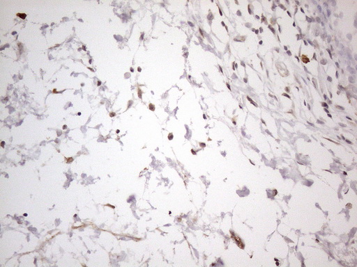 SNRPB2 Antibody - Immunohistochemical staining of paraffin-embedded Human bladder tissue within the normal limits using anti-SNRPB2 mouse monoclonal antibody. (Heat-induced epitope retrieval by 1mM EDTA in 10mM Tris buffer. (pH8.5) at 120°C for 3 min. (1:150)
