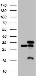 SNRPB2 Antibody - HEK293T cells were transfected with the pCMV6-ENTRY control (Left lane) or pCMV6-ENTRY SNRPB2 (Right lane) cDNA for 48 hrs and lysed. Equivalent amounts of cell lysates (5 ug per lane) were separated by SDS-PAGE and immunoblotted with anti-SNRPB2 (1:2000).