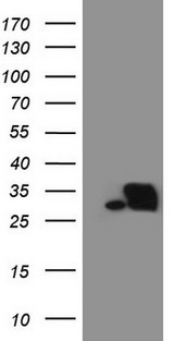 SNRPB2 Antibody - HEK293T cells were transfected with the pCMV6-ENTRY control. (Left lane) or pCMV6-ENTRY SNRPB2. (Right lane) cDNA for 48 hrs and lysed. Equivalent amounts of cell lysates. (5 ug per lane) were separated by SDS-PAGE and immunoblotted with anti-SNRPB2. (1:2000)
