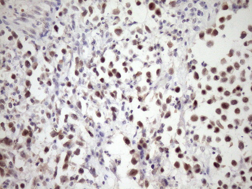 SNRPB2 Antibody - Immunohistochemical staining of paraffin-embedded Human bladder tissue within the normal limits using anti-SNRPB2 mouse monoclonal antibody. (Heat-induced epitope retrieval by Tris-EDTA, pH8.0)(1:150)