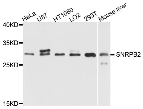 SNRPB2 Antibody - Western blot analysis of extract of various cells.