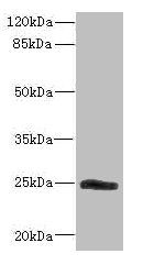 SNRPB2 Antibody - Western blot All Lanes: SNRPB2 antibody IgG at 2.26ug/ml+ Mouse kidney tissue Secondary Goat polyclonal to rabbit IgG at 1/10000 dilution Predicted band size: 25 kDa Observed band size: 25 kDa
