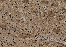 SNRPB2 Antibody - 1:100 staining rat brain tissue by IHC-P. The sample was formaldehyde fixed and a heat mediated antigen retrieval step in citrate buffer was performed. The sample was then blocked and incubated with the antibody for 1.5 hours at 22°C. An HRP conjugated goat anti-rabbit antibody was used as the secondary.