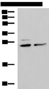 SNRPB2 Antibody - Western blot analysis of Hela and K562 cell lysates  using SNRPB2 Polyclonal Antibody at dilution of 1:1600